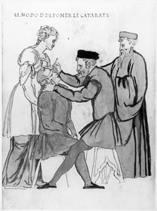 د سترګو جراحي د موتیا د لرې کولو لپاره (په کاغذ باندې قلم او رنګ) پولی autorstwa Spanish School